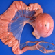 1 Infundibulum, 2 Magnum, 3 Isthmus, 4 Uterus, 5 Vagina with egg inside. Photo: Wikipedia